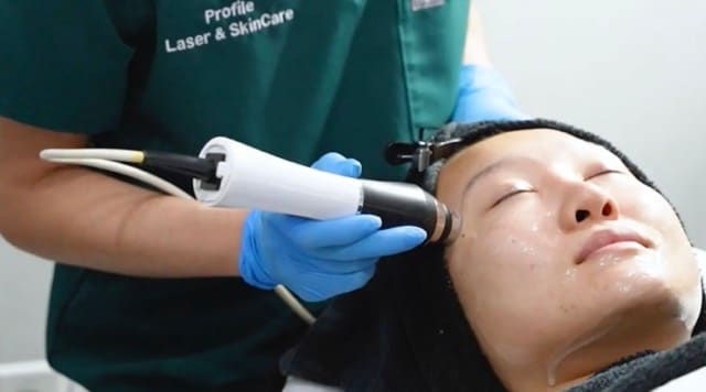 OxyGeneo Super Facial treatment
