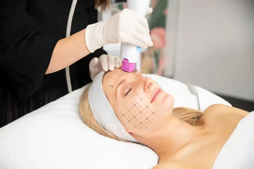 Thermage FLX Now Available