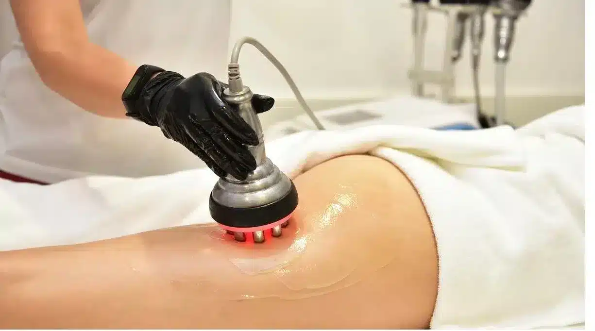 Body Sculpting & SculpSure Richmond, BC