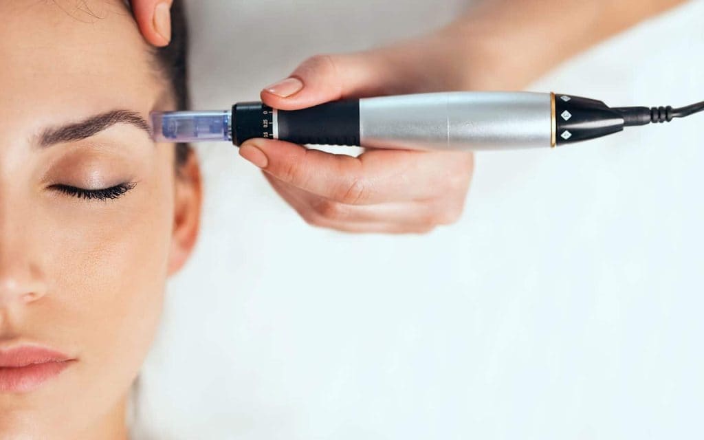RF Microneedling / Morpheus8